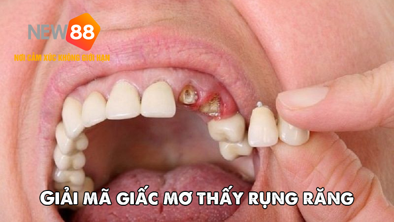 Giải Mã Giấc Mơ Nằm Mơ Thấy Rụng Răng – Điềm Gì Đang Đến Với Bạn? 5 Góc nhìn khoa học qua giấc mơ thấy rụng răng